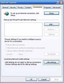 lan settings