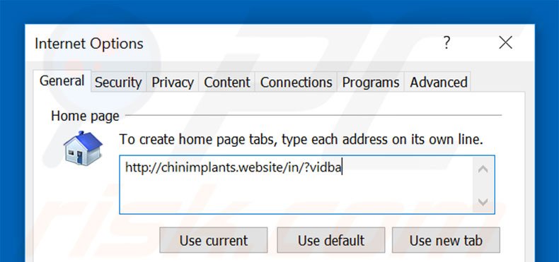Removing chinimplants.website from Internet Explorer homepage