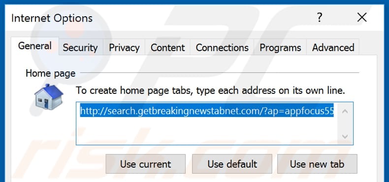 Removing search.getbreakingnewstabnet.com from Internet Explorer homepage